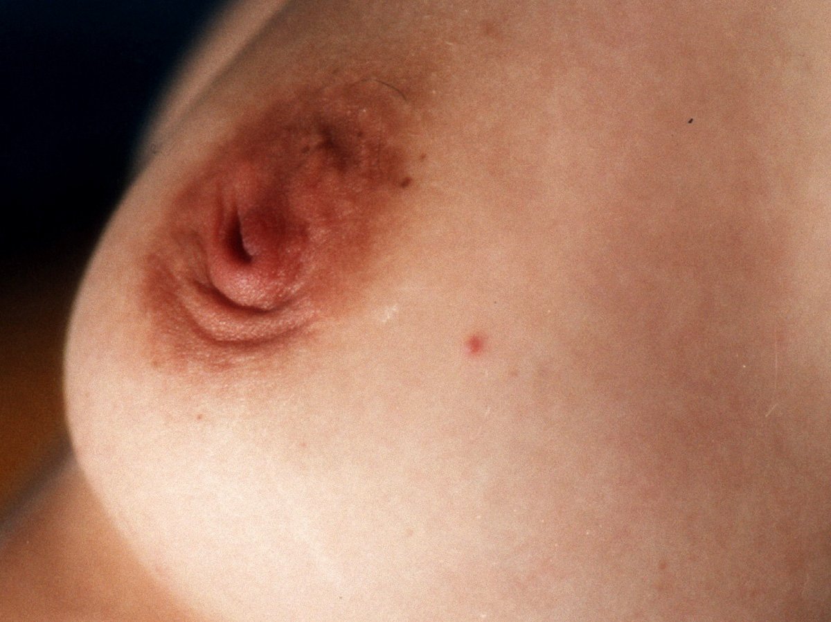 Фото женских сосков груди