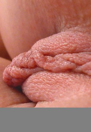 Мясистые половые губы (52 фото)