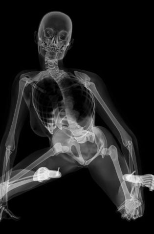 Женщина под рентгеном (60 фото)