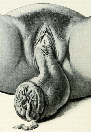 Строение женских пол органов (86 фото)
