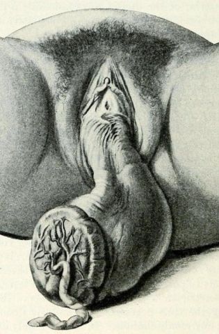 Строение женских пол органов (86 фото)