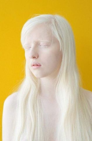 Девушки альбиносы (82 фото)