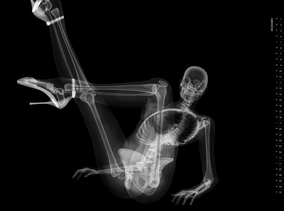 голая девушка рентген