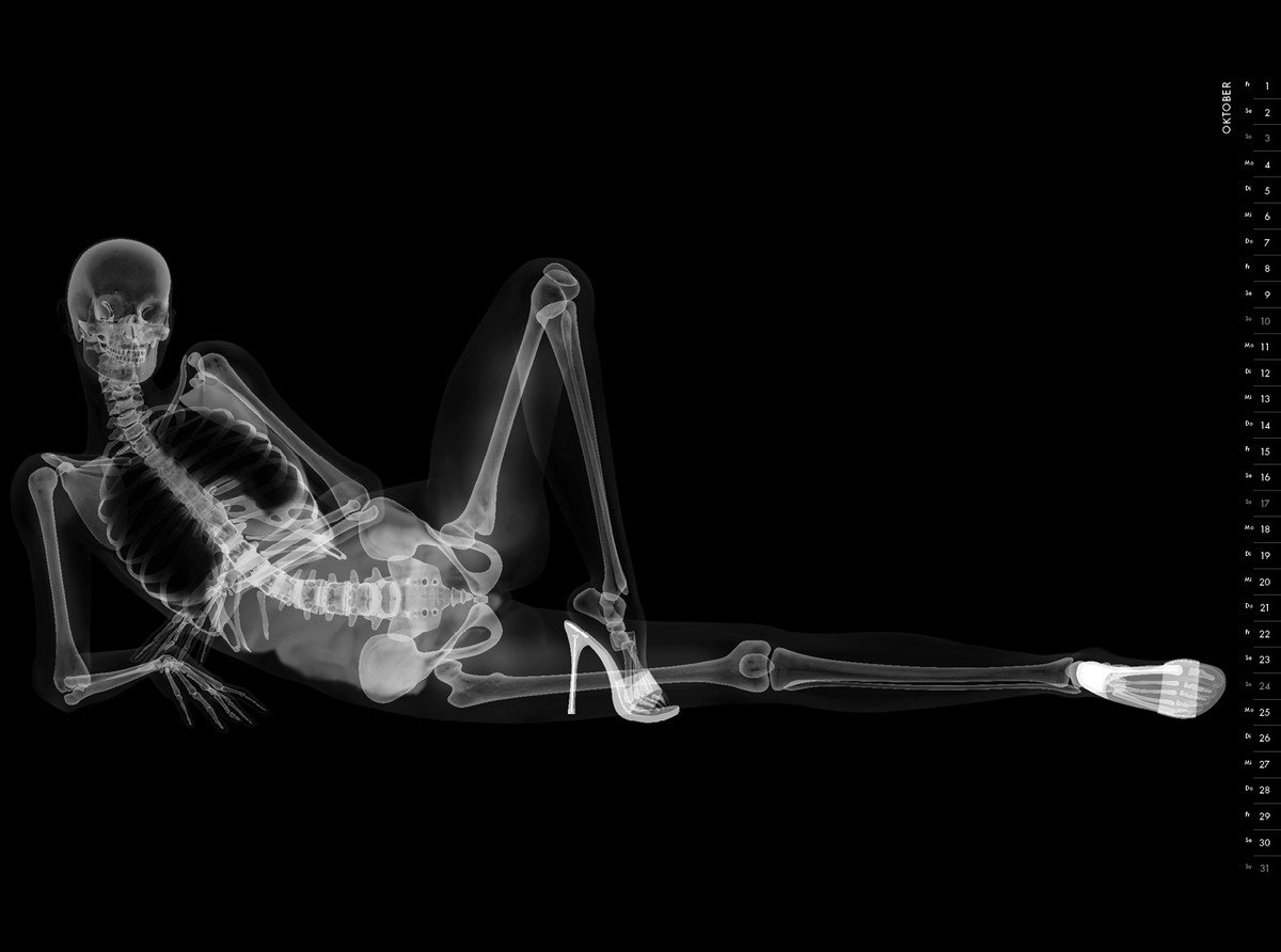 Художник представил своё видение секса при помощи рентгеновских снимков