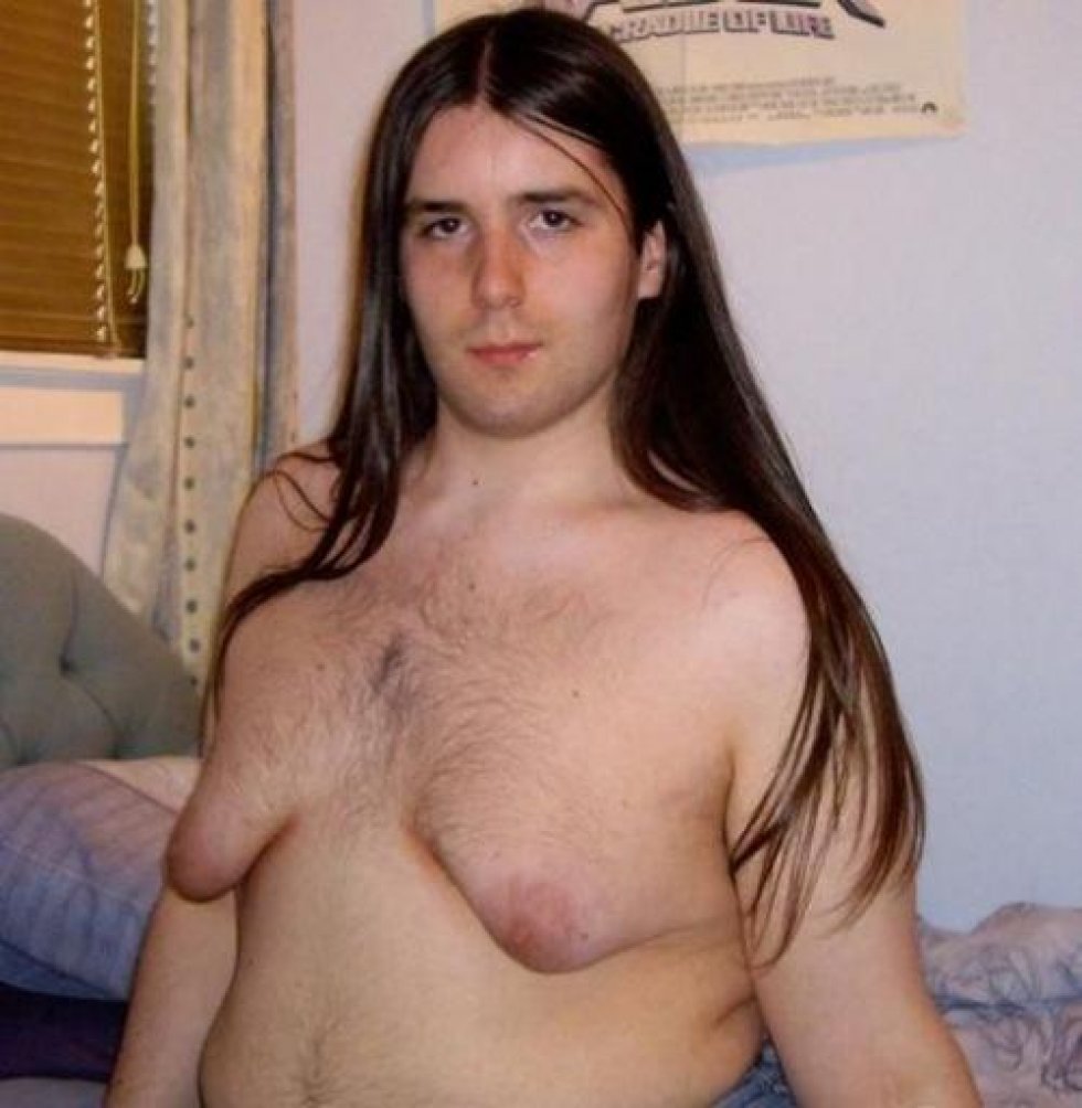 фото голая некрасивая грудь фото 104